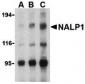 NALP1 Antibody