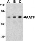 AATF Antibody