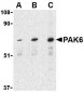 PAK6 Antibody