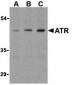 ATR Antibody