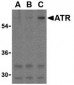 ATR Antibody