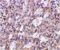 TLR2 Antibody