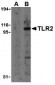 TLR2 Antibody