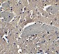 TIRAP Antibody
