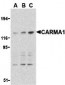 CARMA1 Antibody