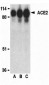 ACE2 Antibody