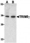 TRIM5 gamma Antibody