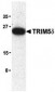 TRIM5 delta Antibody