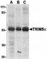 TRIM5 alpha Antibody