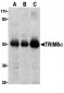 TRIM5 alpha Antibody