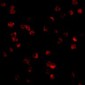 TLR8 Antibody