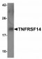 Bcl-2 Antibody