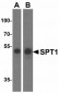 Bcl-2 Antibody