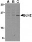 Bcl-2 Antibody