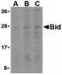 Bid Antibody