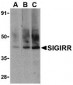 SIGIRR Antibody