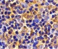 UBC13 Antibody