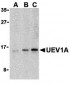 UEV1A Antibody