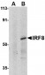 IRF8 Antibody