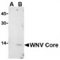 West Nile Virus Core Antibody