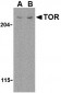 TOR Antibody