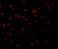 RPS6K1 Antibody