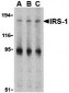 IRS-1 Antibody