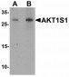 Adiponectin Antibody