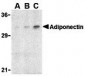 Adiponectin Antibody