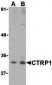 CTRP1 Antibody