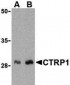 CTRP1 Antibody