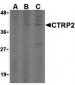 CTRP2 Antibody