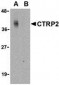 CTRP2 Antibody