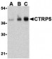 CTRP5 Antibody