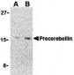 Precerebellin Antibody