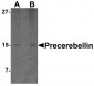 Precerebellin Antibody