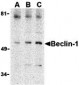 Beclin-1 Antibody