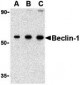 Beclin-1 Antibody