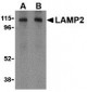 LAMP-2 Antibody