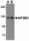 PIST Antibody