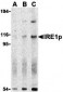 IRE1p Antibody