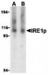 IRE1p Antibody