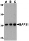 BAP31 Antibody