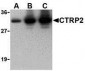 CTRP2 Antibody