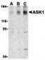 ASK1 Antibody