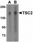 ATF6 Antibody