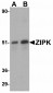 ATF6 Antibody