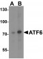 ATF6 Antibody