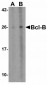 TOLLIP Antibody