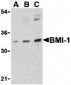 BMI-1 Antibody